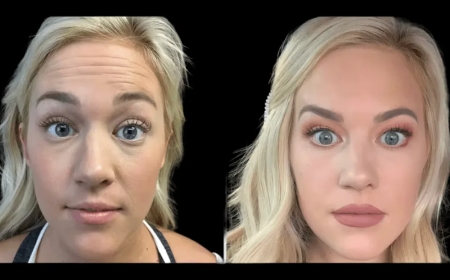 Meet the Best Doctors in dubai Specializing in Botox and Anti-Aging