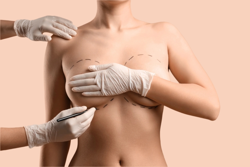Why Choosing the Best Breast Augmentation Surgeon in Dubai Can Make a Difference in Your Results