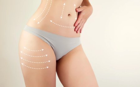 Liposuction Surgery Wisdom from Best Liposuction Surgeon in Dubai