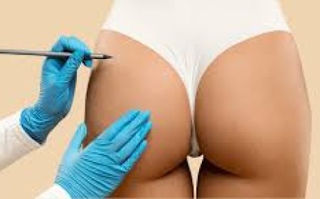 Why Butt Fat Transfer Surgery in Dubai Is the Best Option for Natural Buttock Augmentation