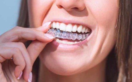 Bite Problems Invisalign Can Help Correct Effectively