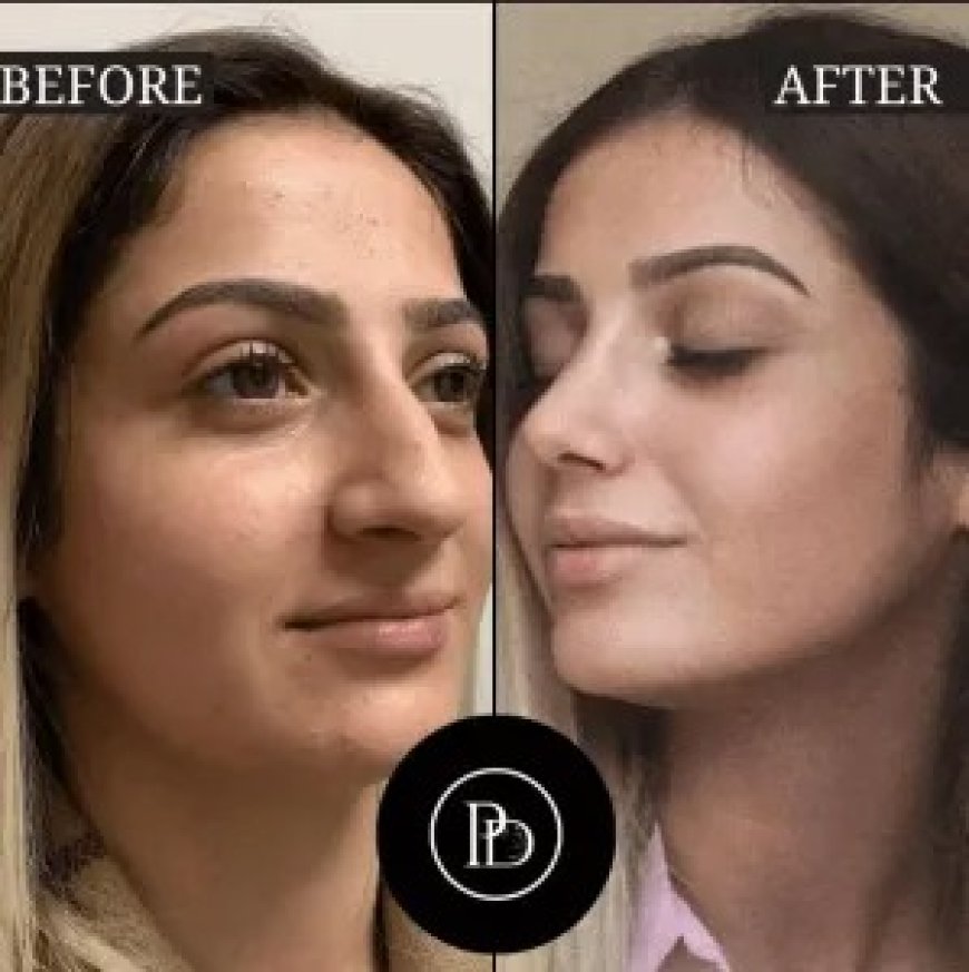 Glowing Skin Starts Here: My Visit to Best Aesthetic Clinic in Dubai