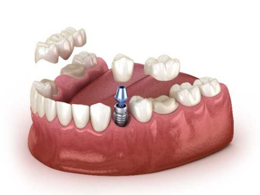 Simple, Effective Smile Treatments in Lancaster