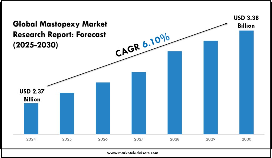 Mastopexy Market Growth Rate & Highlights