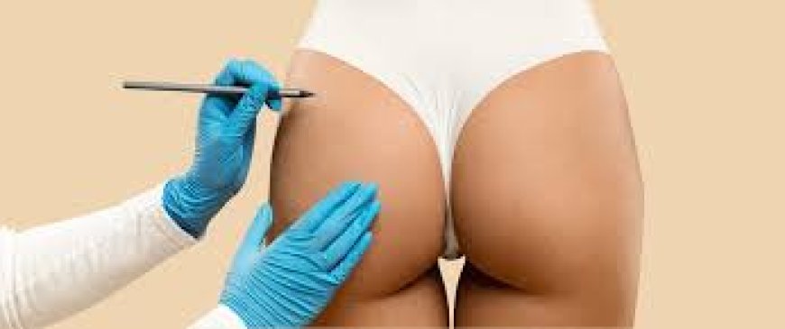 Why Butt Fat Transfer Surgery in Dubai Is the Best Option for Natural Buttock Augmentation