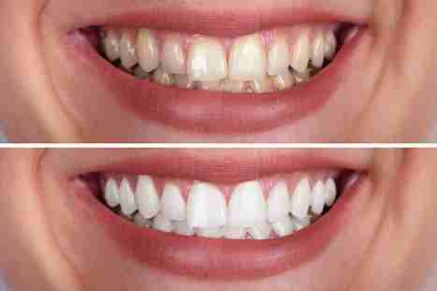 Image Source - Private Dentist Fulham