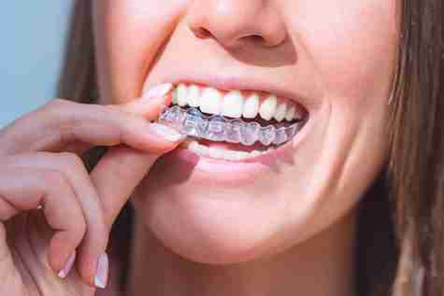 Image Source - Private Dentist Fulham